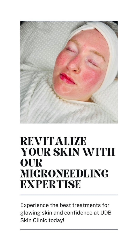 Micro Needling London After Photo