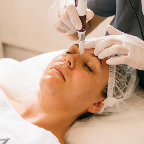 The Best Micro Needling Services Near Canary Wharf