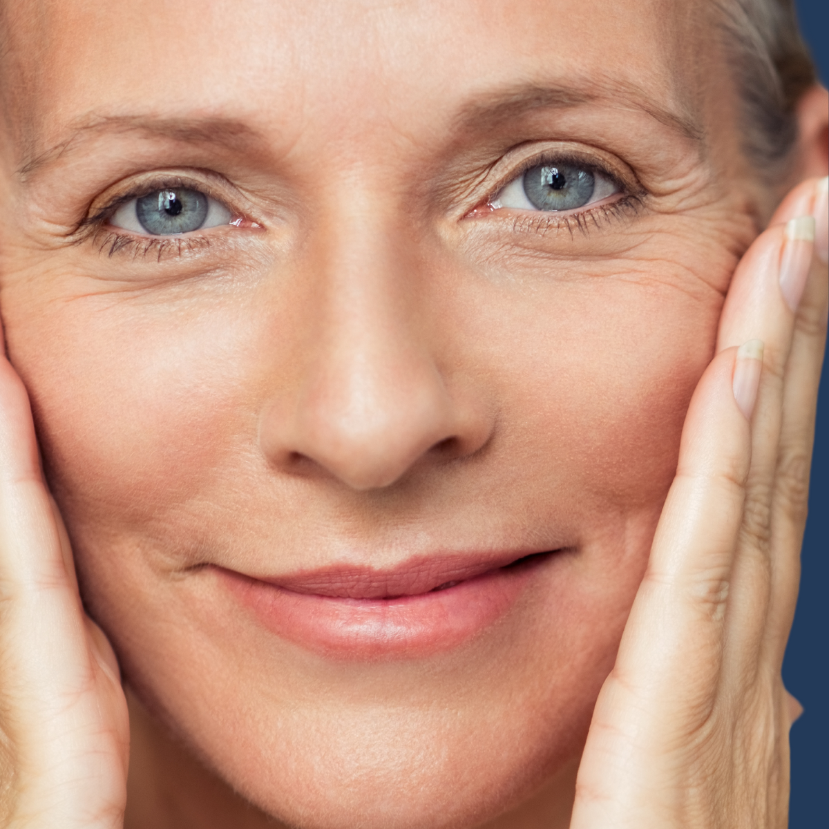 A close-up image of a smiling person receiving a facial treatment, specifically Profhilo skin treatment, which is meant to rejuvenate the skin.