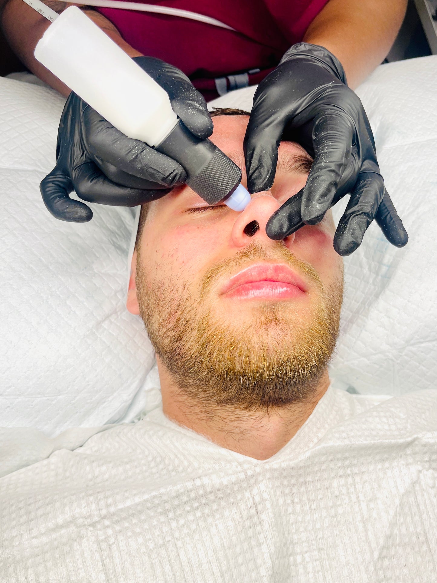 Microdermabrasion Facial Resurfacing Gift Voucher - UDB Skin Clinic East London