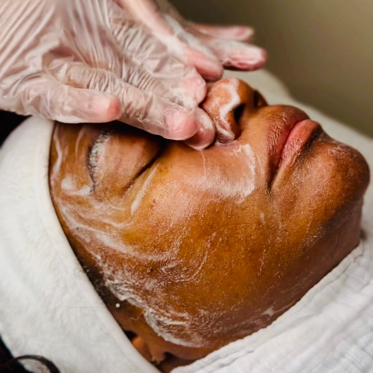 Person receiving a facial treatment with gloved hands applying a product to the face.